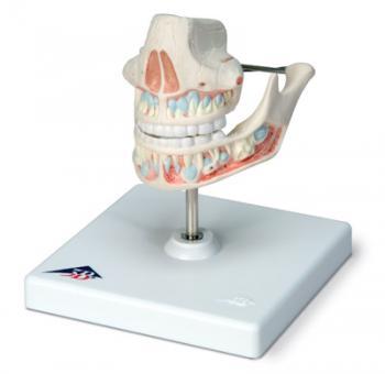 Dislocation of the tooth